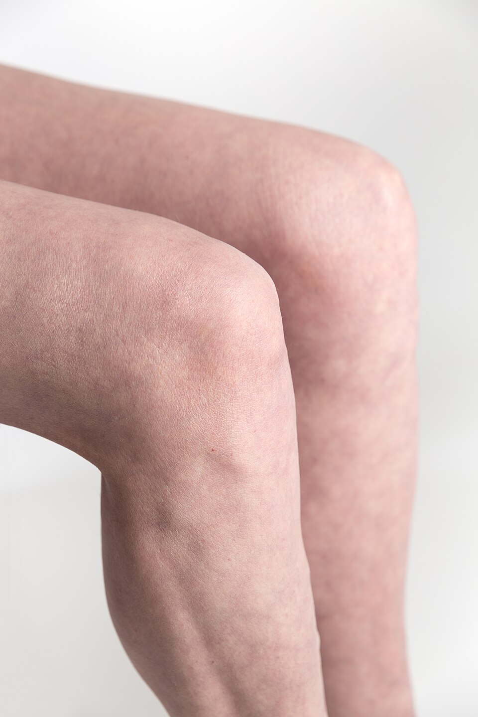Free the Knees